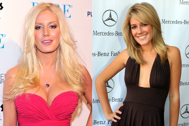 Top 10 vedete cu implanturi mamare nereușite