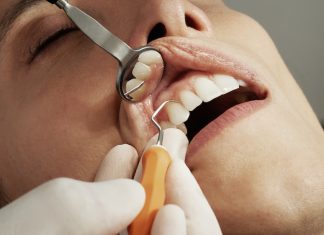 Ce este parodontita și cum se poate trata