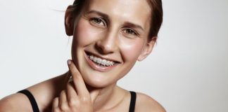 Cum decurge corectarea dinților cu un aparat dentar din safir